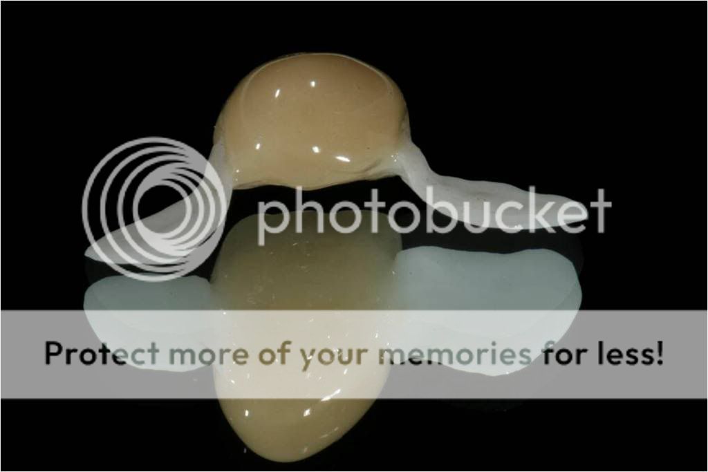 Maryland Bridge D6548 Retainers/D6245 Pontic Drake Dental Lab Photo by